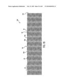 Endoprosthesis Having Foot Extensions diagram and image