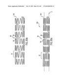 Endoprosthesis Having Foot Extensions diagram and image