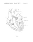 ANNULOPLASTY WITH ENHANCED ANCHORING TO THE ANNULUS BASED ON TISSUE HEALING diagram and image