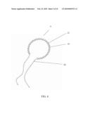 ANNULOPLASTY WITH ENHANCED ANCHORING TO THE ANNULUS BASED ON TISSUE HEALING diagram and image