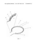 ANNULOPLASTY WITH ENHANCED ANCHORING TO THE ANNULUS BASED ON TISSUE HEALING diagram and image