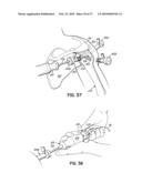 APPARATUS AND METHODS FOR TENDON OR LIGAMENT REPAIR diagram and image