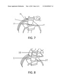 WIRE LOCK RING INSERTION TOOL KIT AND METHOD diagram and image