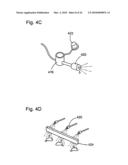 Sodium Bicarbonate Vacuum Bag Inserts diagram and image