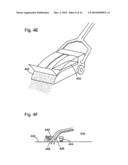 Sodium Bicarbonate Vacuum Bag Inserts diagram and image