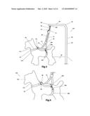 Double loop auto-adjust pet restraint device diagram and image