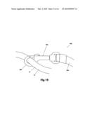 Double loop auto-adjust pet restraint device diagram and image