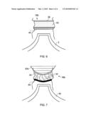 Energy Absorbing Structures diagram and image