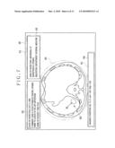 Medical image display apparatus and method, and program for displaying medical image diagram and image