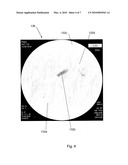  METHOD AND SYSTEM FOR DIAGNOSING AND TREATING A PEST INFESTED BODY diagram and image