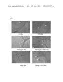 METHODS OF MAKING A TRANSPLANTABLE BONE REPAIR SYSTEM USING MULTIPOTENT STEM CELLS diagram and image