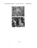 Tumour Vaccine Comprising Allogenic or Xenogeneic Tumour Cells diagram and image