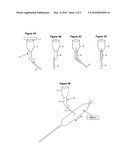 METHODS AND APPARATUSES FOR COATING BALLOON CATHETERS diagram and image