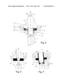 DEVICE FOR SECURING A DENTAL ATTACHMENT TO AN IMPLANT diagram and image