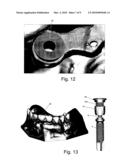 DEVICE FOR SECURING A DENTAL ATTACHMENT TO AN IMPLANT diagram and image