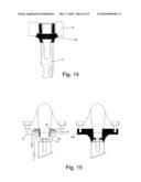 DEVICE FOR SECURING A DENTAL ATTACHMENT TO AN IMPLANT diagram and image