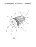 Dental implant diagram and image