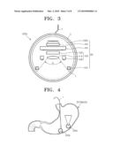 CAPSULE-TYPE IMAGE PHOTOGRAPHING APPARATUS AND ENDOSCOPY USING THE SAME diagram and image