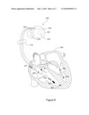 Syncope Logbook and Method of Using Same diagram and image