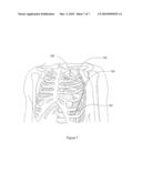 Syncope Logbook and Method of Using Same diagram and image