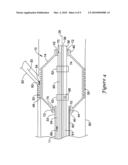 ELECTROACTIVE POLYMER ACTIVATION SYSTEM FOR A MEDICAL DEVICE diagram and image