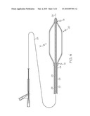 Multilayer Medical Balloon diagram and image