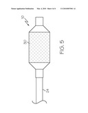 Multilayer Medical Balloon diagram and image