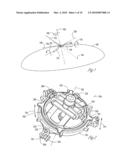 Organ Access Device and Method diagram and image