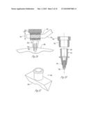 Organ Access Device and Method diagram and image