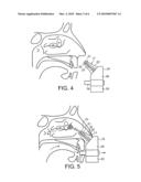 DELIVERY DEVICE AND METHOD diagram and image