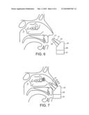 DELIVERY DEVICE AND METHOD diagram and image