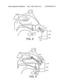 DELIVERY DEVICE AND METHOD diagram and image