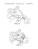 DELIVERY DEVICE AND METHOD diagram and image