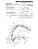 CATHETER CONFIGURED FOR INCREMENTAL ROTATION diagram and image