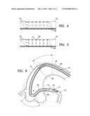 CATHETER CONFIGURED FOR INCREMENTAL ROTATION diagram and image