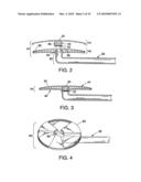 METHOD AND APPARATUS FOR REDUCING INTRAOCULAR PRESSURE diagram and image