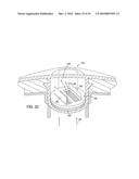 METHOD AND APPARATUS FOR REDUCING INTRAOCULAR PRESSURE diagram and image