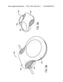 CASSETTE FOR USE IN A MEDICATION DELIVERY FLOW SENSOR ASSEMBLY AND METHOD OF MAKING THE SAME diagram and image