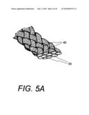 POLYMER COMPOSITES FOR BIOMEDICAL APPLICATIONS AND METHODS OF MAKING diagram and image