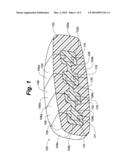 RAIL-BASED MODULAR DISC NUCLEUS PROSTHESIS diagram and image