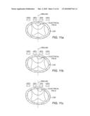 MULTIPLE TUNABLE CENTRAL CATHODES ON A PADDLE FOR INCREASED MEDIAL-LATERAL AND ROSTRAL-CAUDAL FLEXIBILITY VIA CURRENT STEERING diagram and image