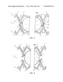 Frangible bridge structure for a stent, and stent including such bridge structures diagram and image