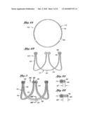 FLEXIBLE HEART VALVE AND ASSOCIATED CONNECTING BAND diagram and image