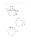 FLEXIBLE HEART VALVE AND ASSOCIATED CONNECTING BAND diagram and image