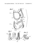 FLEXIBLE HEART VALVE AND ASSOCIATED CONNECTING BAND diagram and image