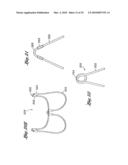 FLEXIBLE HEART VALVE AND ASSOCIATED CONNECTING BAND diagram and image