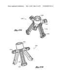 FLEXIBLE HEART VALVE AND ASSOCIATED CONNECTING BAND diagram and image