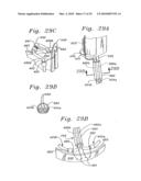 FLEXIBLE HEART VALVE AND ASSOCIATED CONNECTING BAND diagram and image