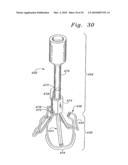 FLEXIBLE HEART VALVE AND ASSOCIATED CONNECTING BAND diagram and image