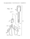 FLEXIBLE HEART VALVE AND ASSOCIATED CONNECTING BAND diagram and image